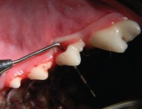 The truth about anesthesia free “dentistry”